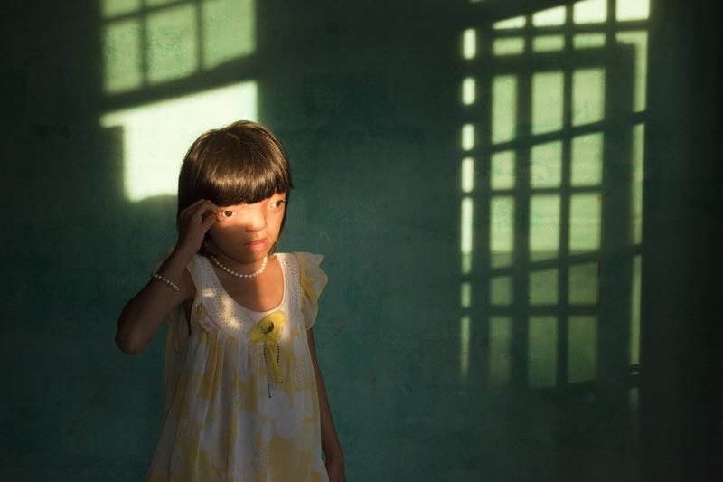 Эд Каши (США). Девятилетняя Нгуен Тхи Ли страдает от заболеваний, которые вызваны дефолиантом «Агент Оранж». Дананга, Вьетнам 2-е место — «Проблемы современности» (одиночные фотографии)
