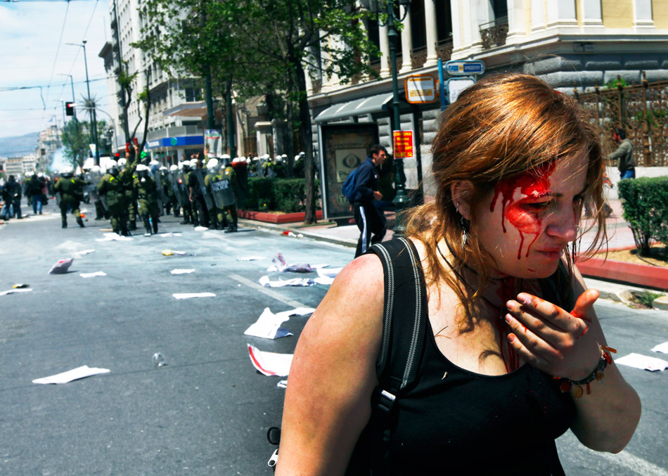 Афины (Греция). Демонстрантка, раненная в столкновении с полицией в центре Афин. 11 мая 2011 года