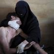 Фотографией года по версии World Press Photo стала работа испанского фотографа Самуэля Аранда, сделанная в коридоре госпиталя во время октябрьских вооруженных столкновений в Йемене.
